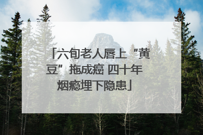 六旬老人唇上“黄豆”拖成癌 四十年烟瘾埋下隐患