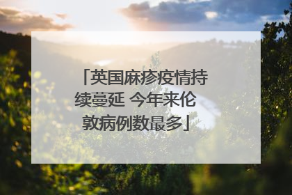 英国麻疹疫情持续蔓延 今年来伦敦病例数最多